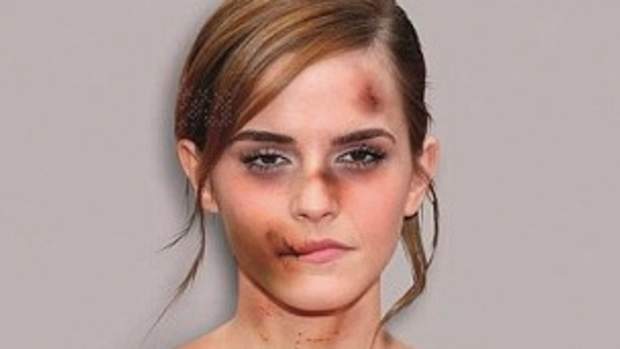 Emma Watson Porn Schoolgirl - Private Emma Watson Photos Stolen And Leaked (Photo ...