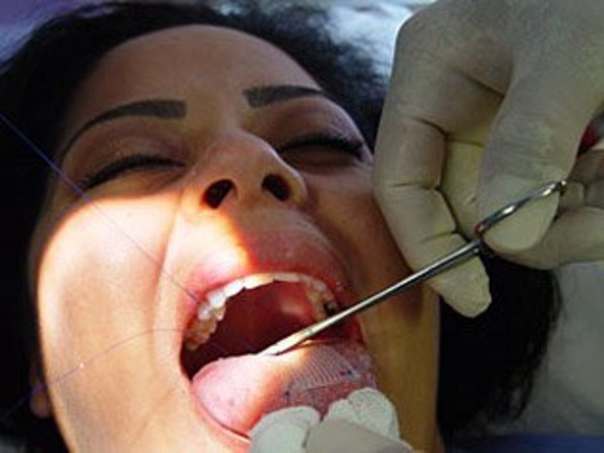  Miracle Patch is Sewn Into Tongue Patients Lose 30 