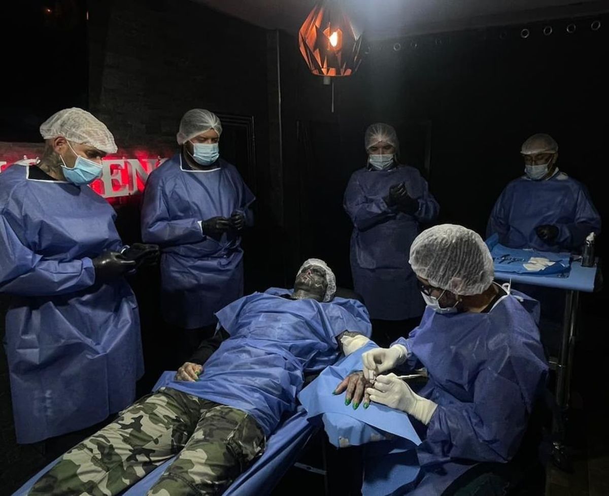 Anthony Loffredo laying on a table during a surgical procedure, Photo Credit: the_black_alien_project/Instagram