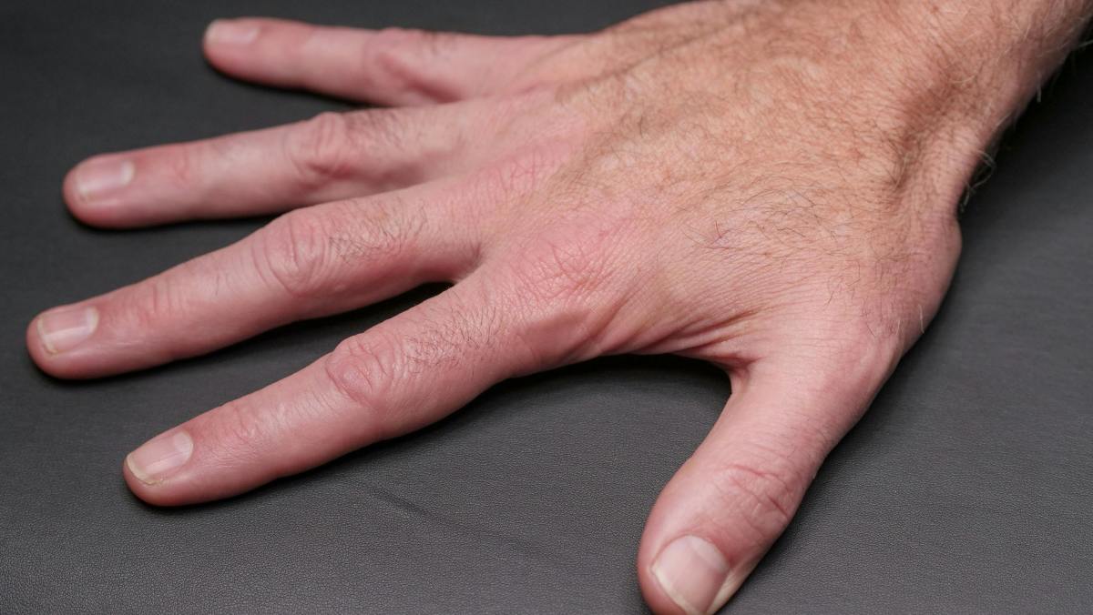 Closeup of a man's hand (for illustrative purposes), Photo Credit: Pexels