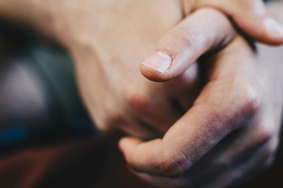 Closeup of a man's hand highlighting his thumb's fingernail (for illustrative purposes), Photo Credit: Pexels