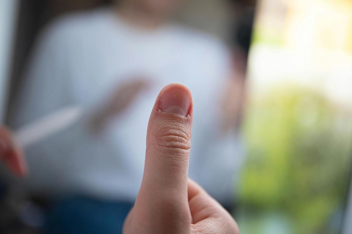 Closeup of a person's thumb (for illustrative purposes), Photo Credit: Pexels