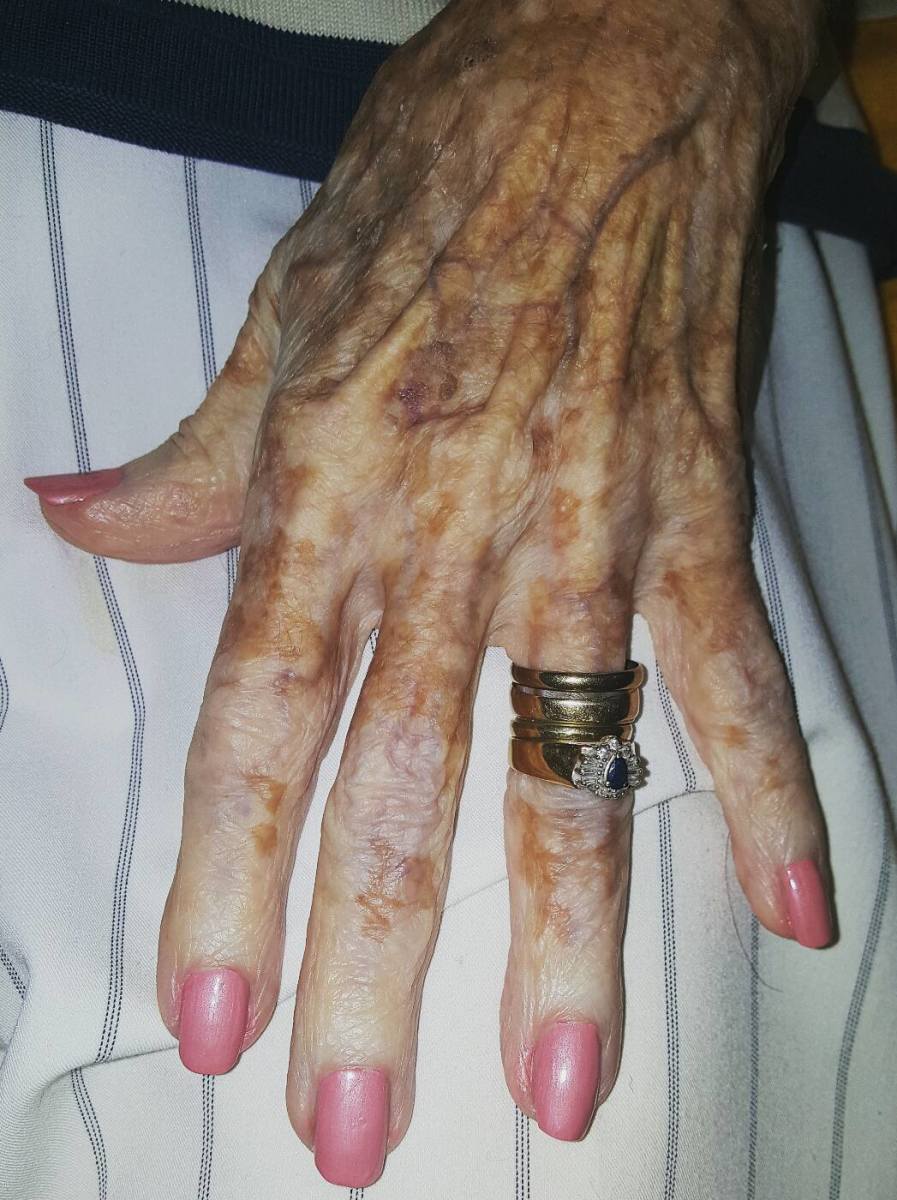 Closeup photo of an elderly woman's hand, Photo Credit: Brandalyn Mae Porter/Facebook