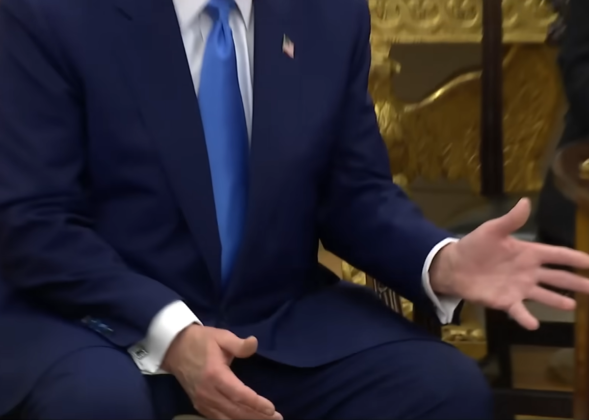 President Donald Trump's hands seen with bruise, Photo Credit: Inside Edition/Youtube